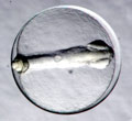 Early embryo